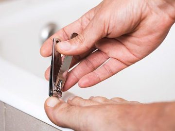 Tips to Prepare Before Going For Toenail Fungus Treatment