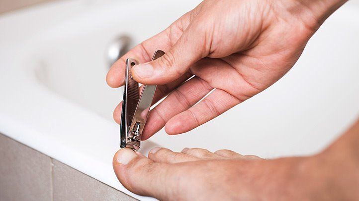 Tips to Prepare Before Going For Toenail Fungus Treatment